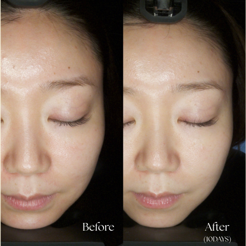 【超数量限定復活】レカルカミスト化粧水