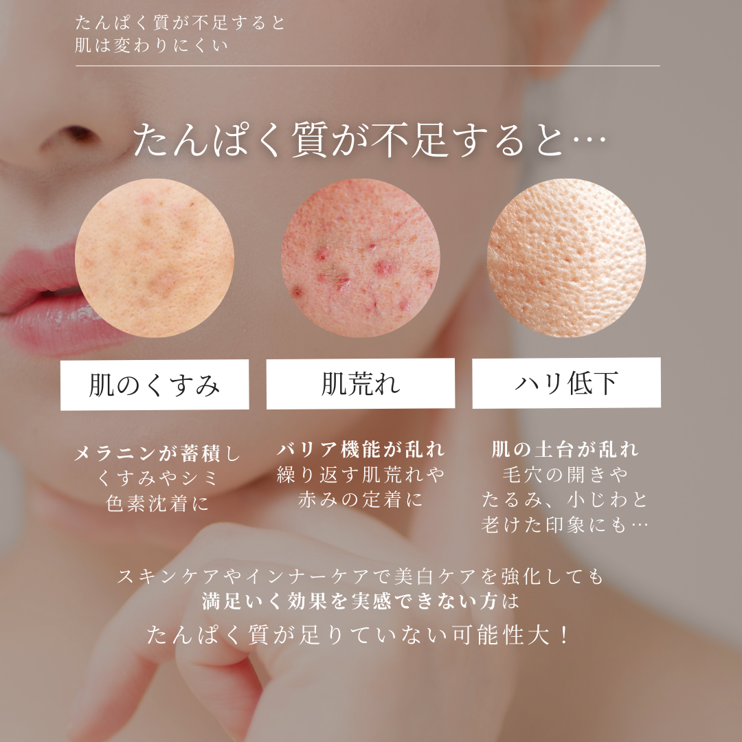 【2月限定】美白のための肌育ケアセット