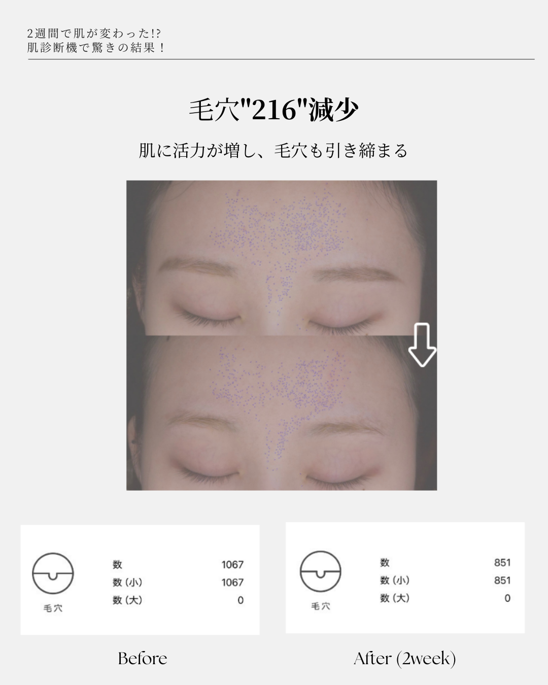 【究極の肌再生】エクソソームセット