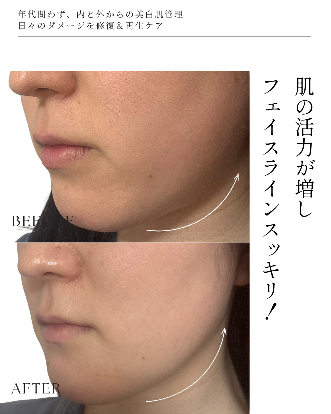 【美白ケアに迷ったら！】全身美箔肌管理セット