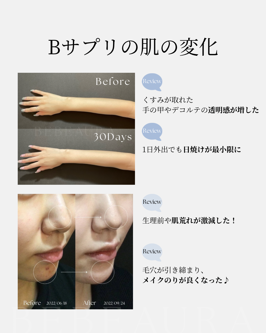 BEBEAURA サプリメント