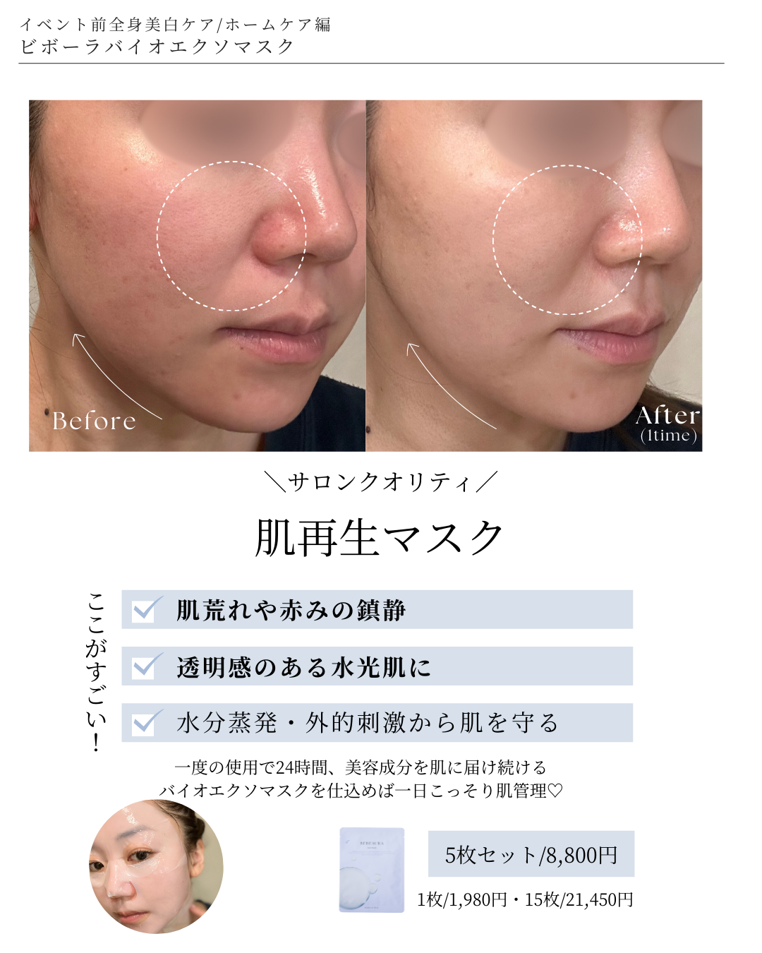 BEBEAURAバイオエクソマスク【15枚】