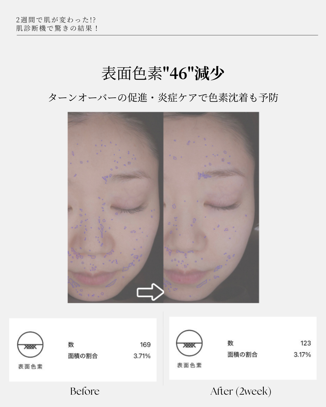 【究極の肌再生】エクソソームセット