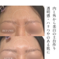 【美白ケアに迷ったら！】全身美箔肌管理セット