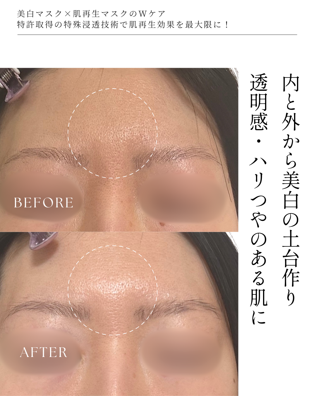 【美白ケアに迷ったら！】全身美箔肌管理セット