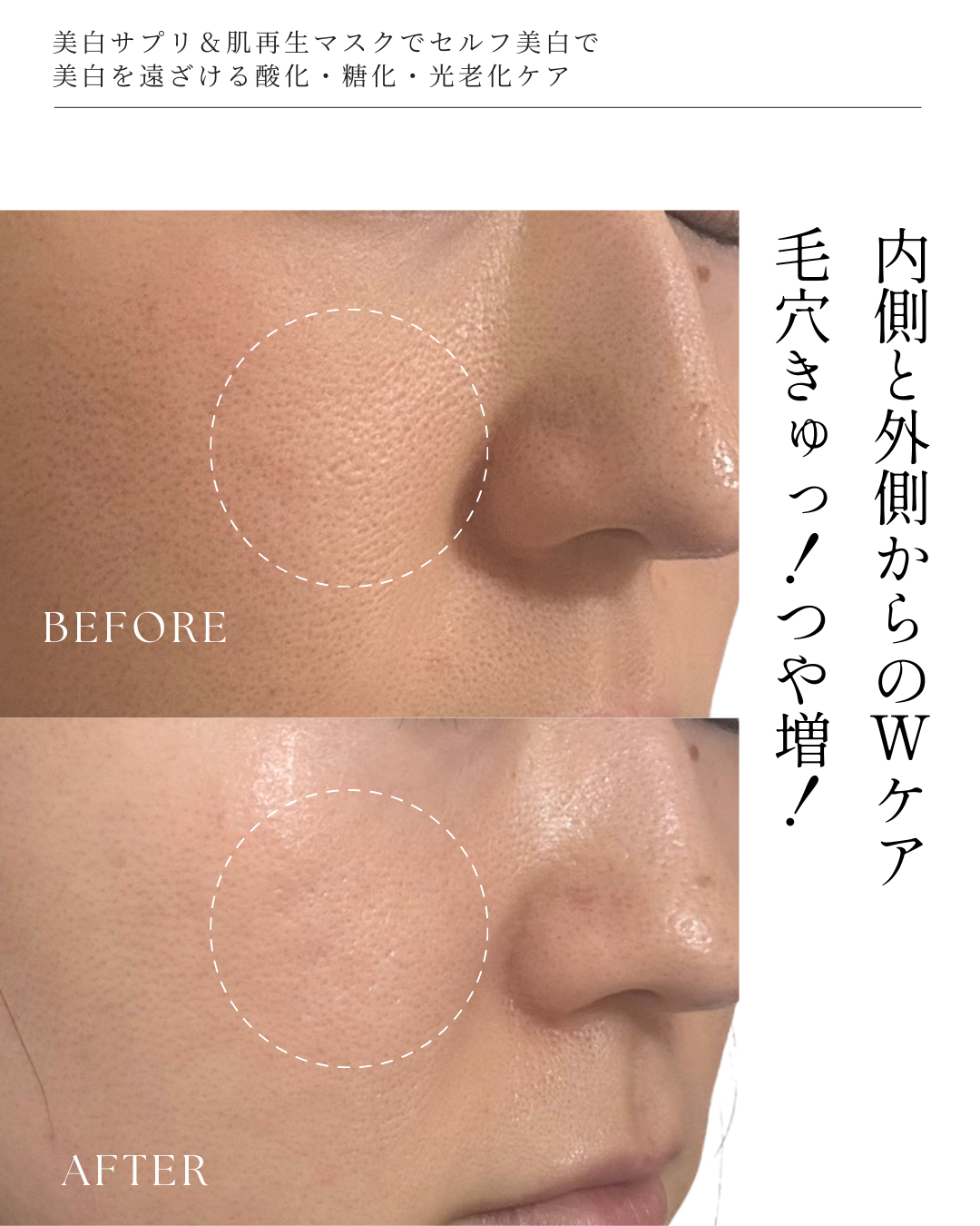 【美白ケアに迷ったら！】全身美箔肌管理セット