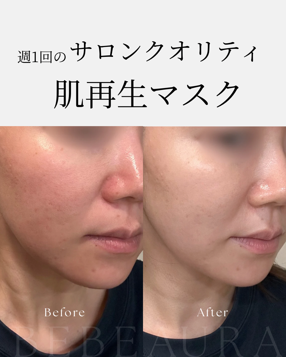 BEBEAURAバイオエクソマスク【15枚】